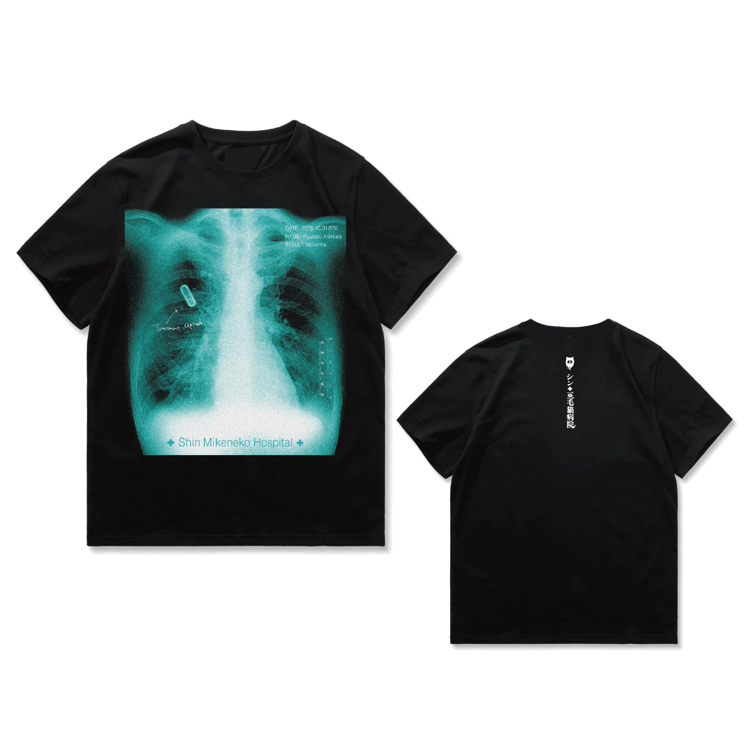 被験体R_X-Subject File TEE